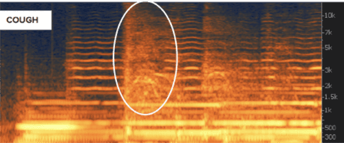 A cough shown on a spectrogram