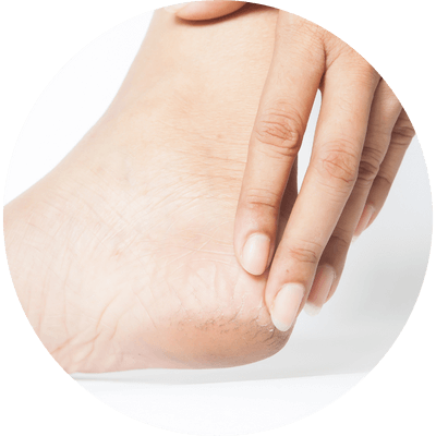 Dry Feet