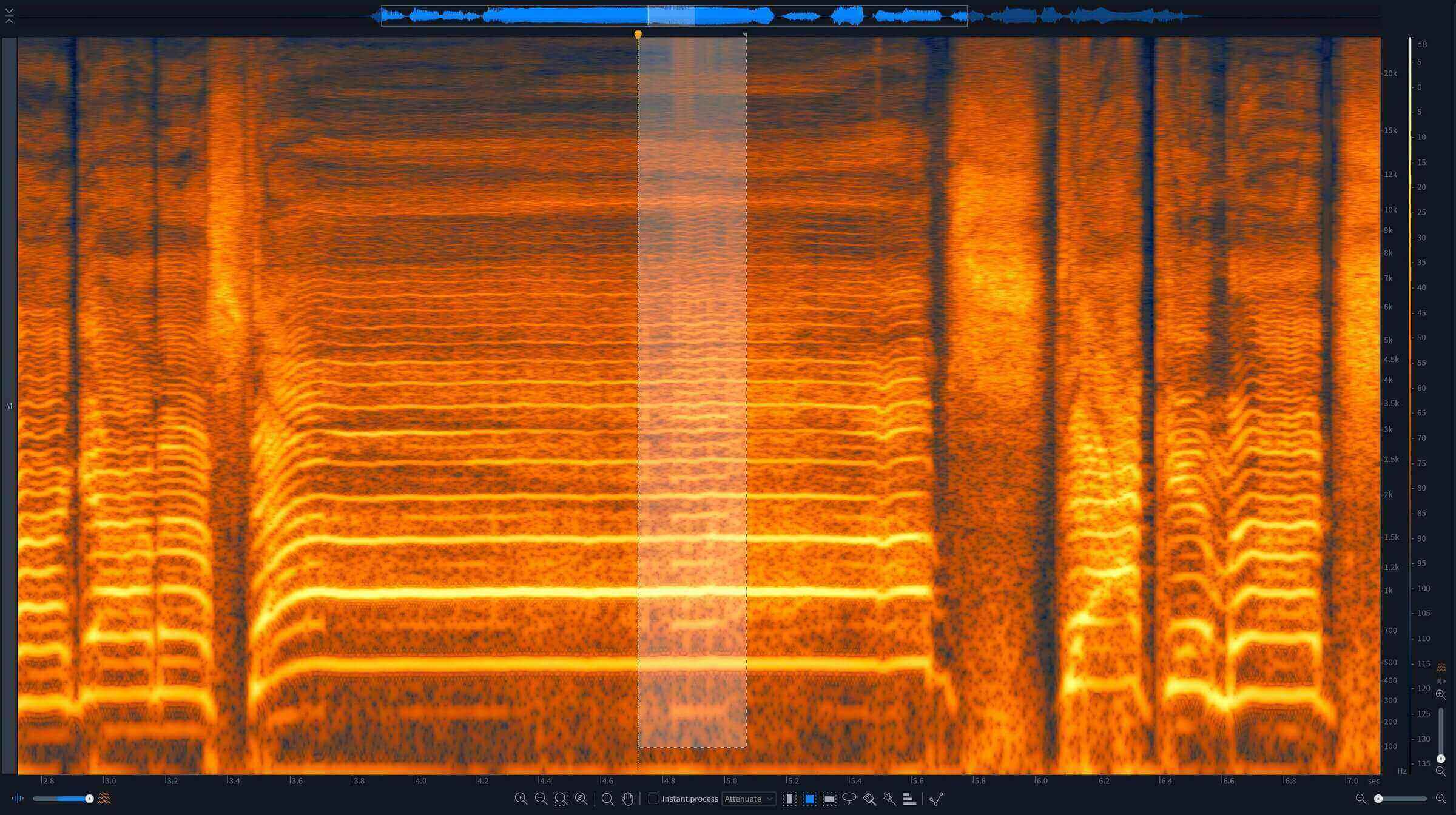 Vocal problems in RX Histogram