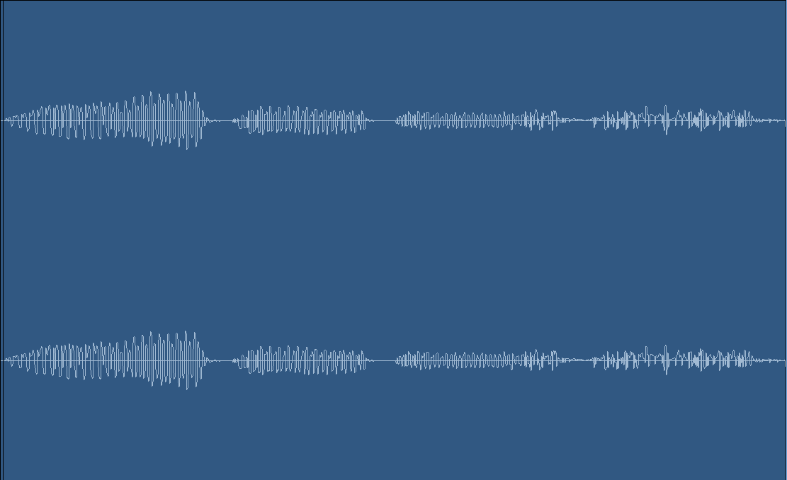 Choppy audio waveform