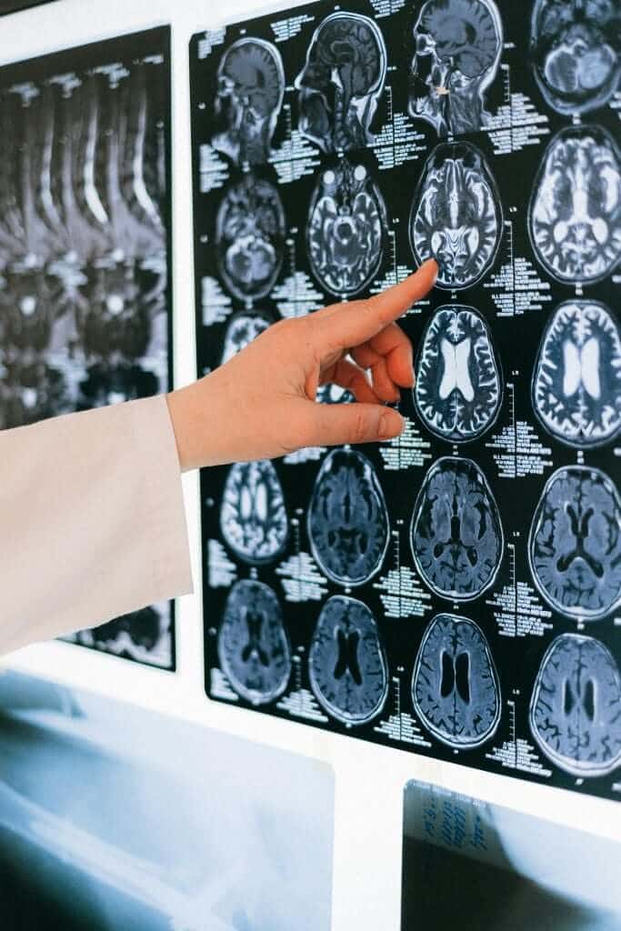 Cognitive Health Boot Camp for Older Adults