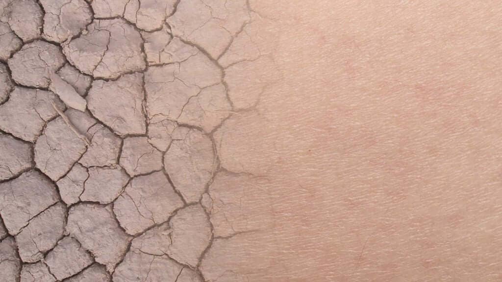 Gesichtspflege für extrem trockene Haut