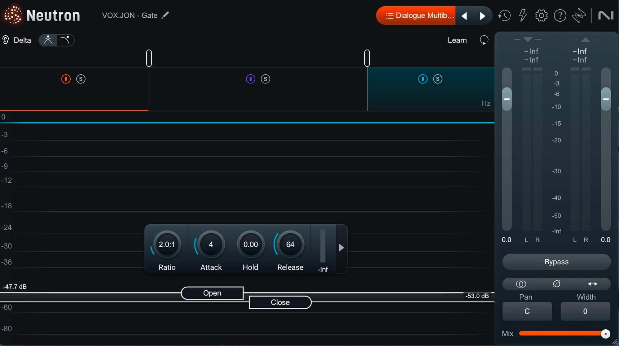 Neutron 5 preset - Dialogue 