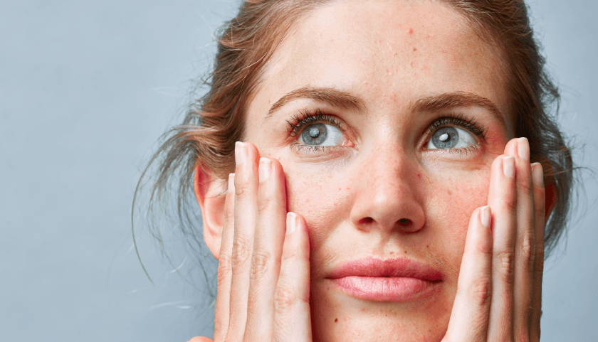 Woman with sensitive skin gently cupping face with hands, showing mild redness and concerned expression