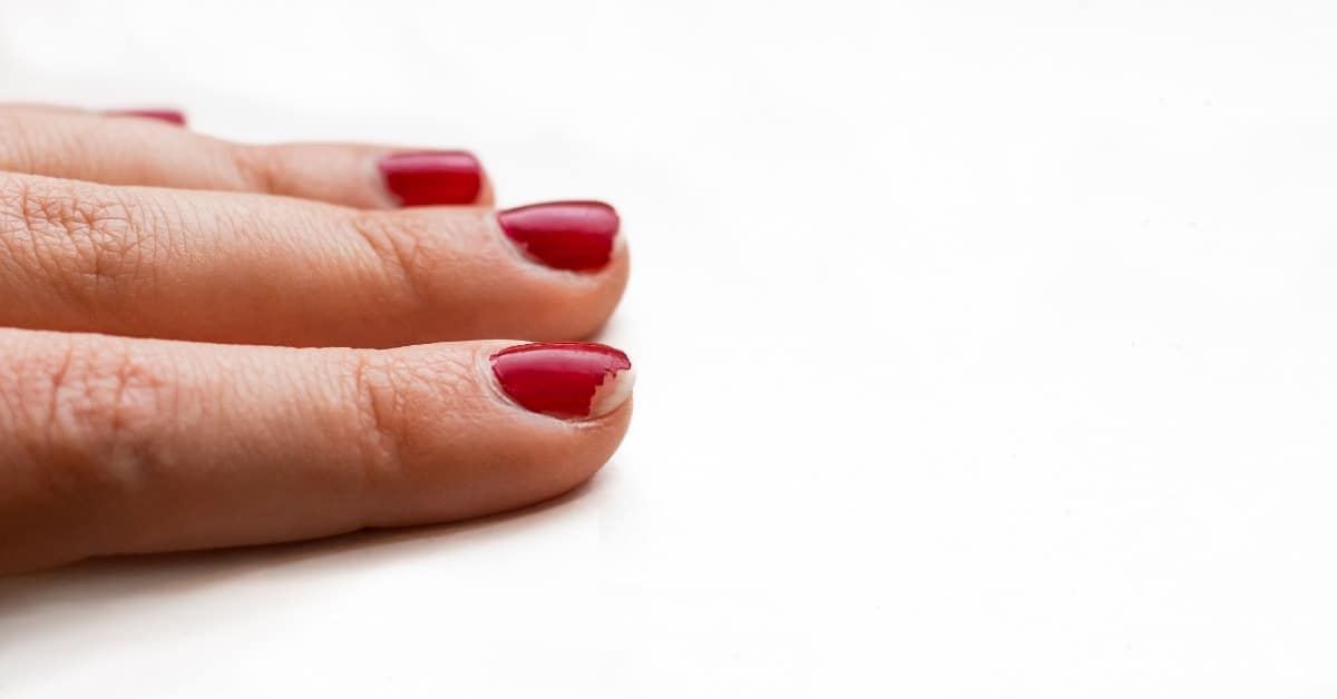 A close-up view shows a hand resting on a white surface. The fingernails feature red nail polish that is chipping.