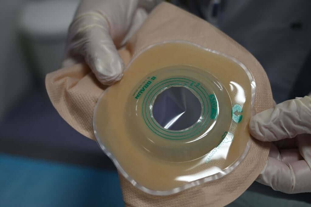 The Caregiver Guide – Living with an Ostomy
