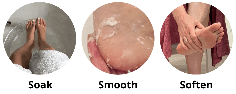 GEHWOL 3 Steps Blog 2
