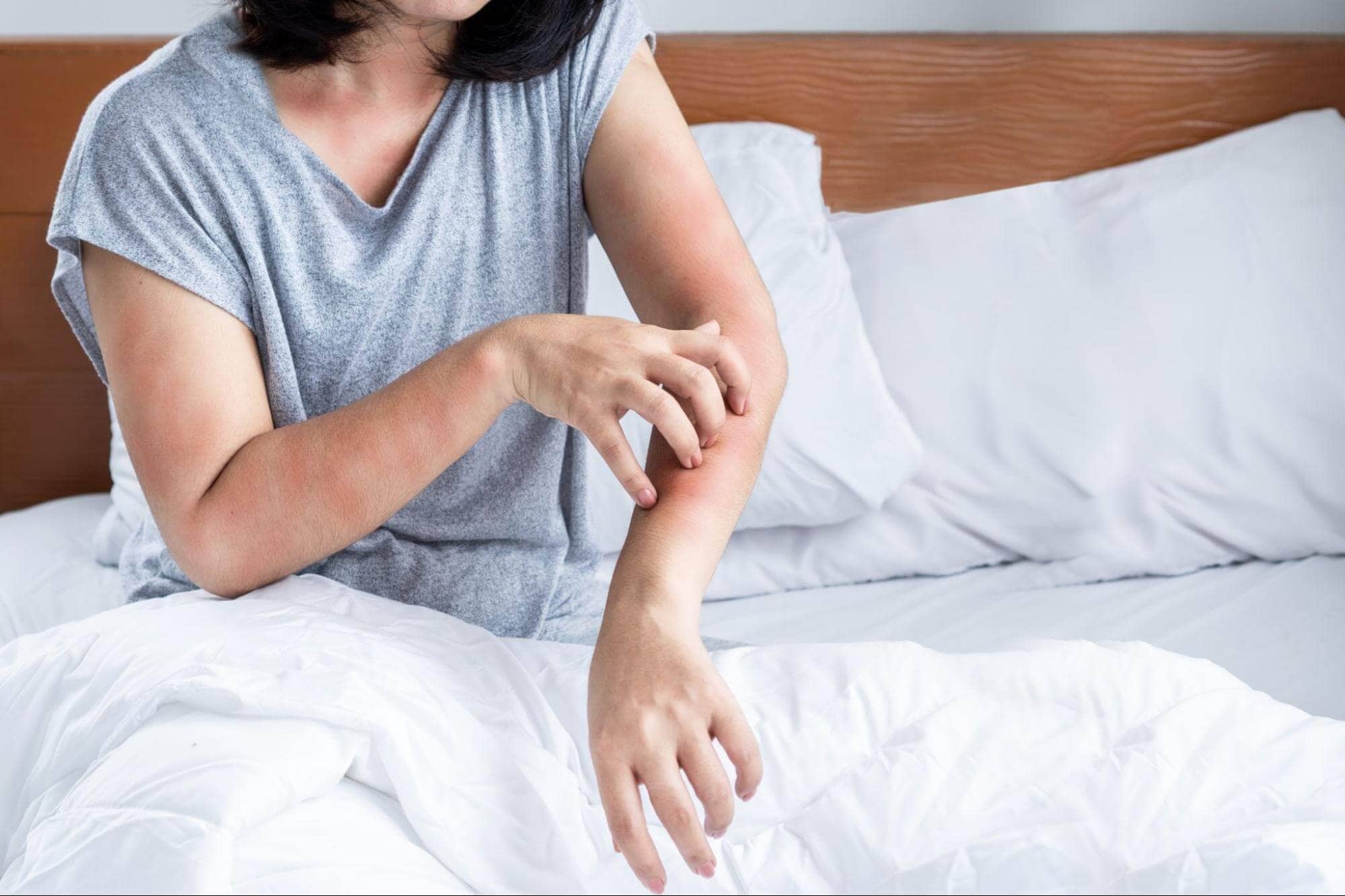 Woman that has itchy skin from allergies